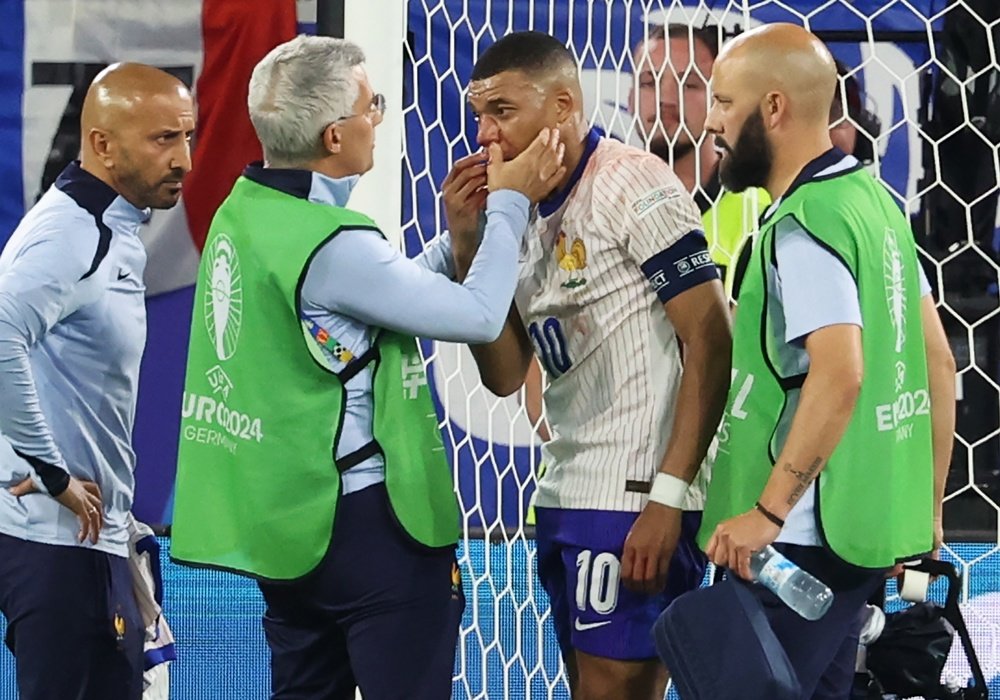 França vence a Áustria em sua estreia na Euro, mas Mbappé sai de campo com suspeita de fratura no nariz